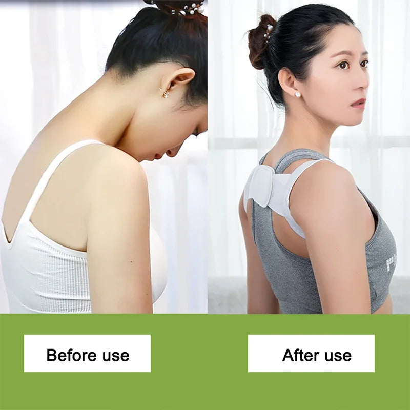 Adjustable Posture Corrector – Back Support Shoulder Belt, Straightens Spine, Corrects Posture